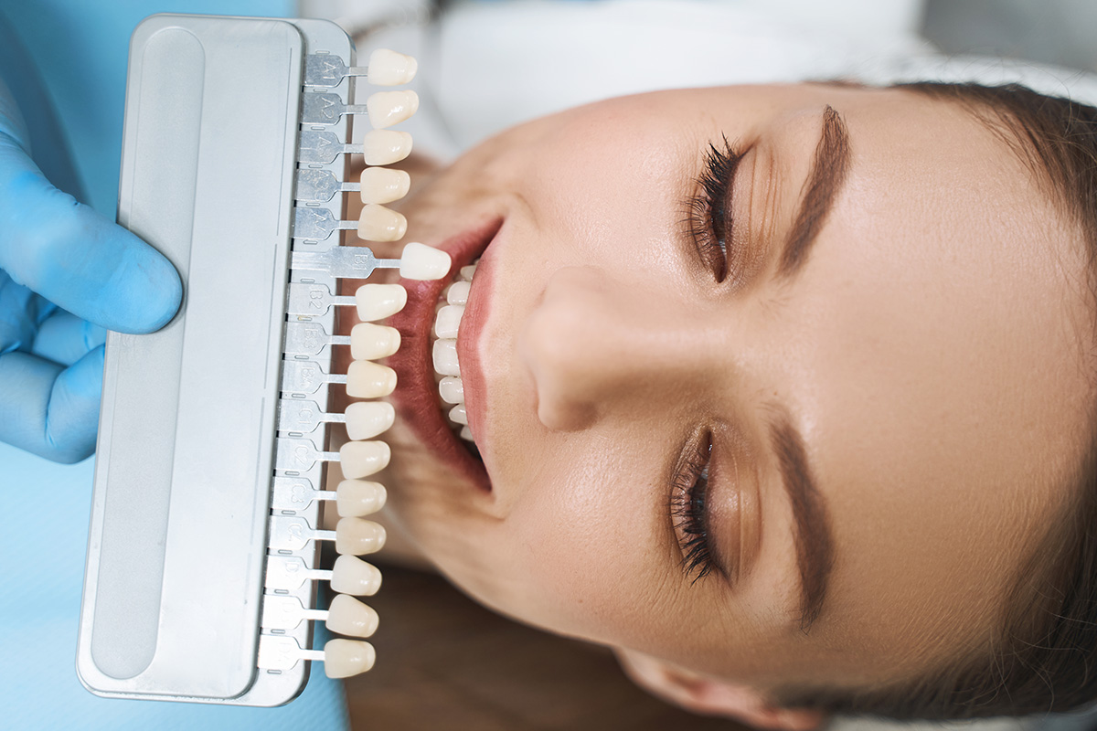 Endodontologische Behandlungen, Leistung: Medizinisches Bleaching